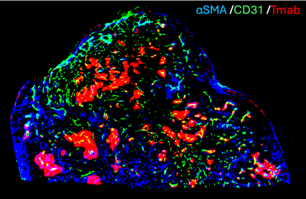 金光助教らのDBSBがん研究チームが、「公益記念財団・医療の基礎的先駆的研究に対する助成事業」に採択！
